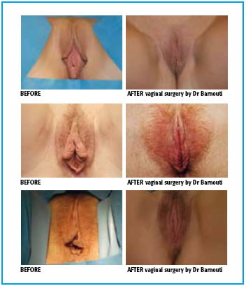 Vagina Swelling After Sex 51