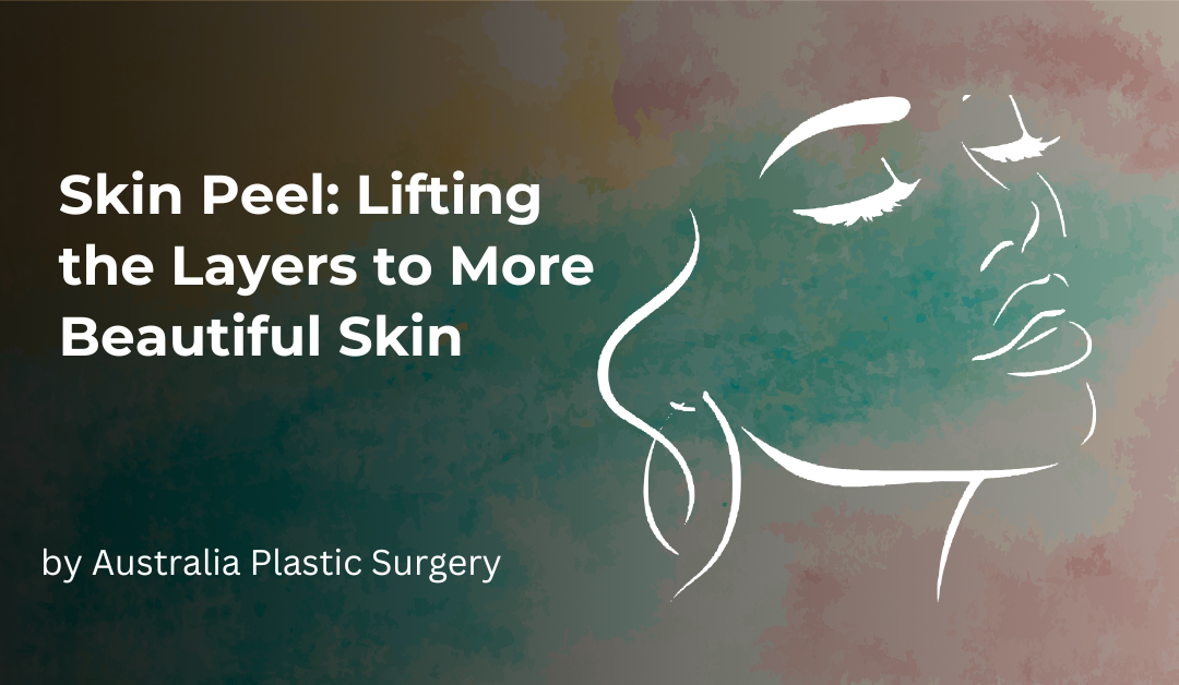 Skin Peel: Lifting the Layers to More Beautiful Skin