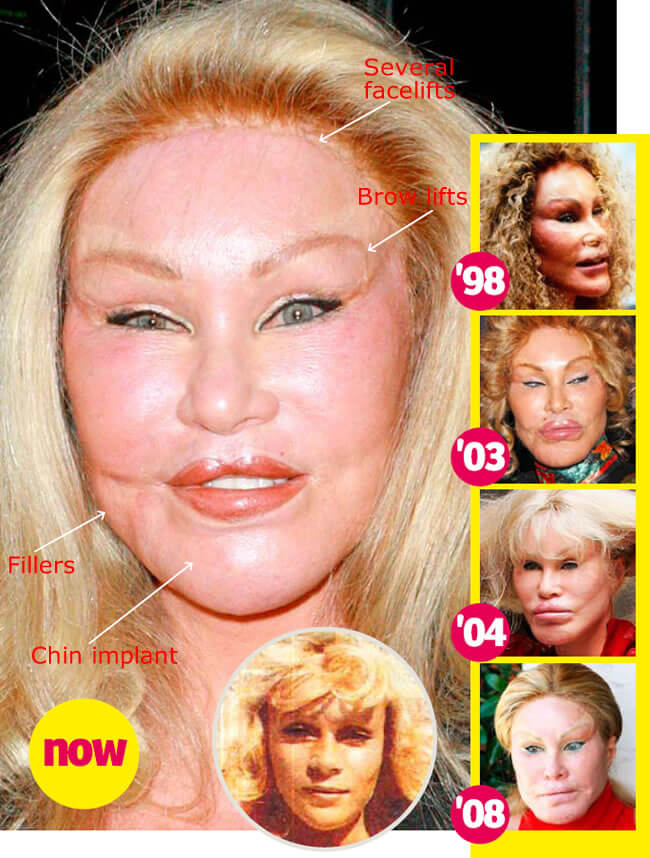Jocelyn Wildenstein Fixed Face