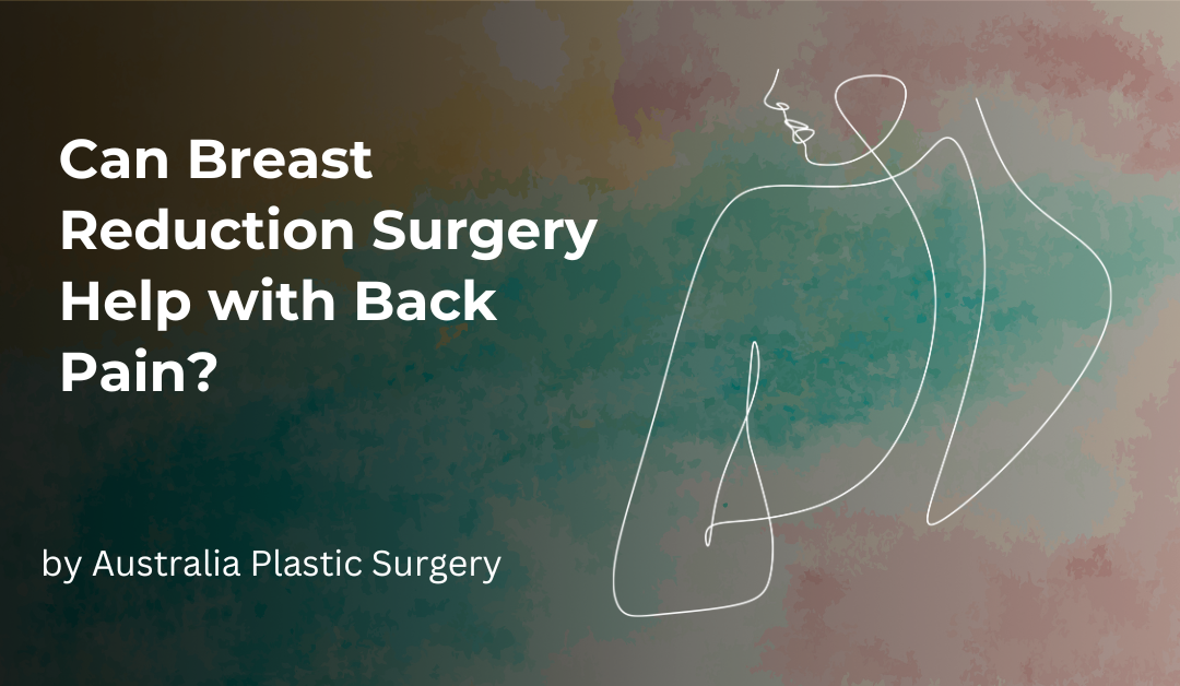 Can Breast Reduction Surgery Help with Back Pain?