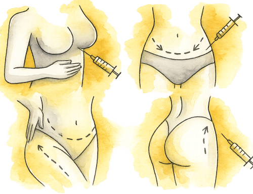 Comprehensive Guide to Post-Pregnancy Procedures: A Path to Recovery and Renewal