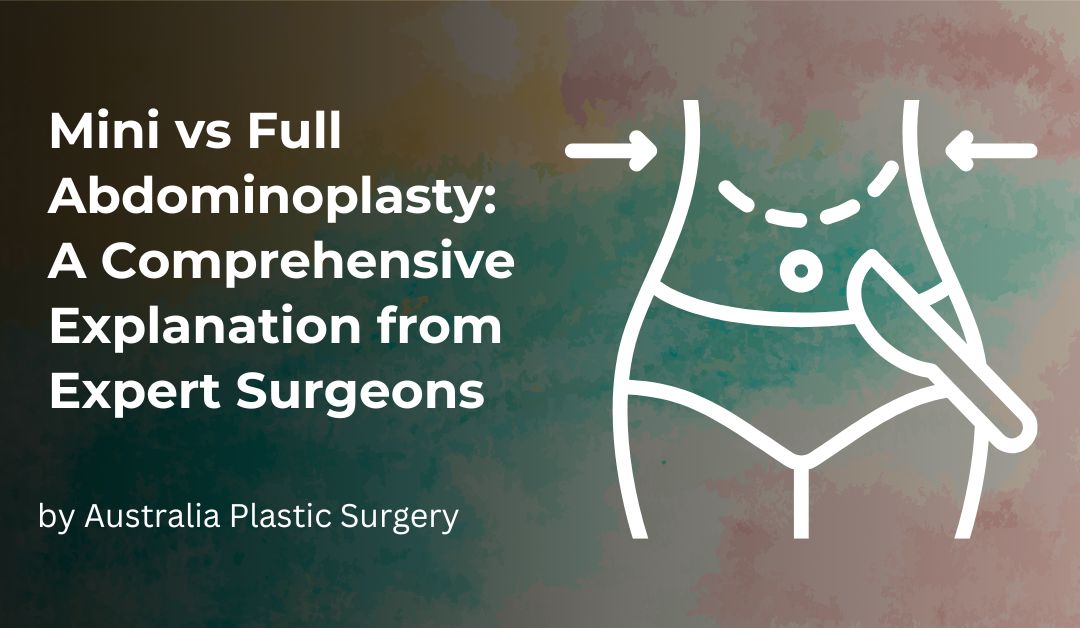 Mini vs Full Abdominoplasty: A Comprehensive Explanation from Expert Surgeons